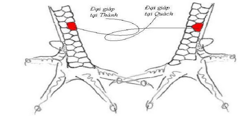 Vảy gà quý đại giáp có những đặc điểm riêng so với độc giáp, liên giáp